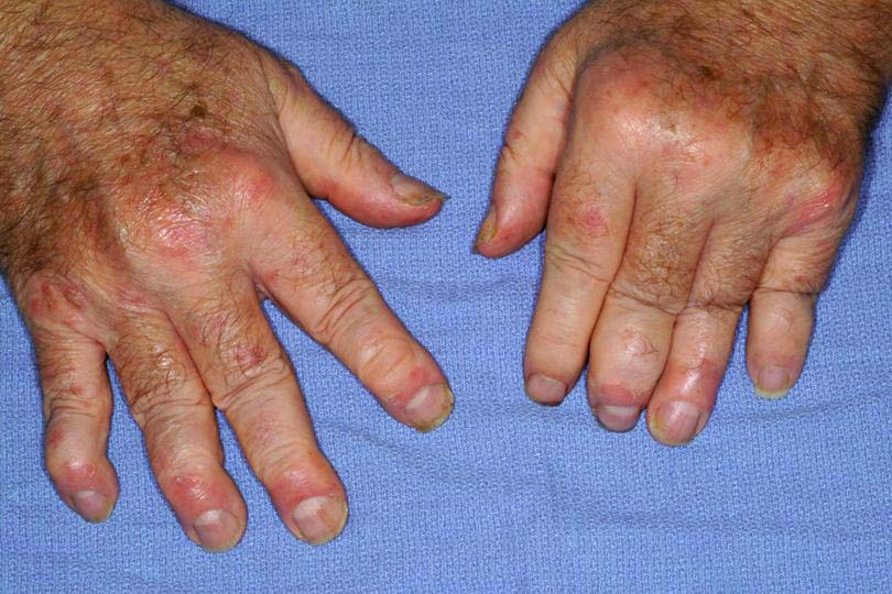 A.R clinic Arthritis & Rheumatism care Trichy